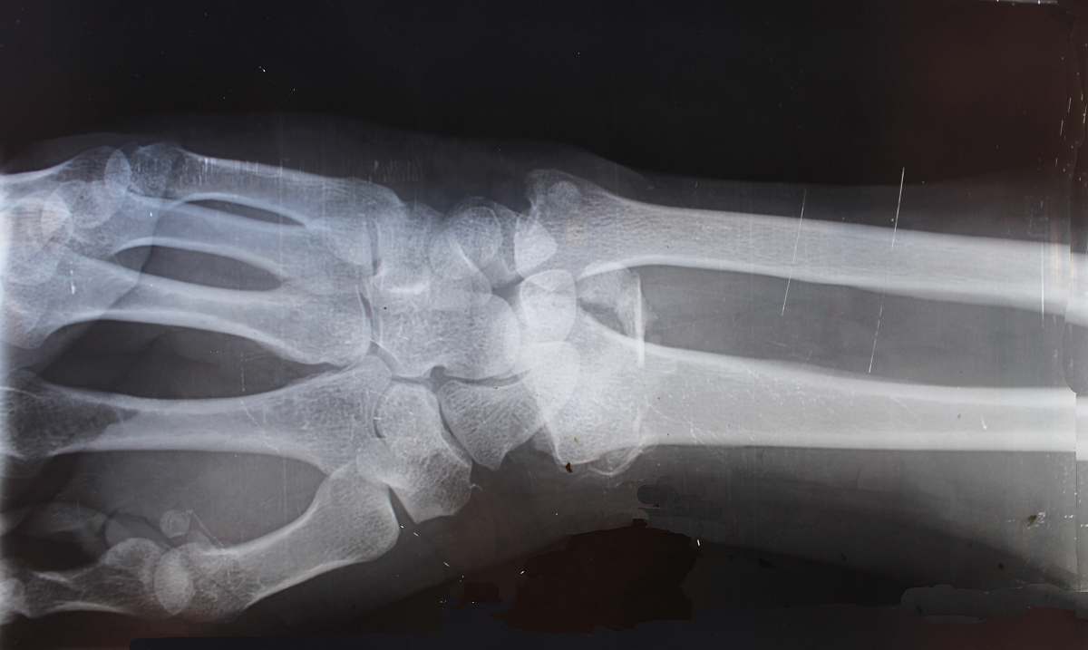ct scan x-ray result grey